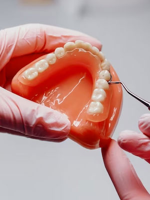 Implantes Dentales
