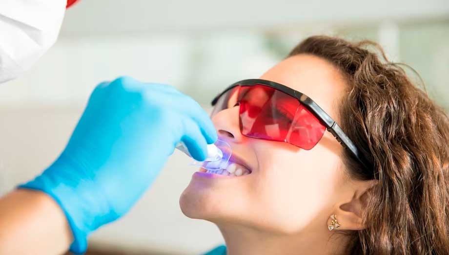 mujer blanqueando sus dientes en un consultorio