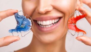 Mujer sonriendo muestra dos tipos de expansores dentales